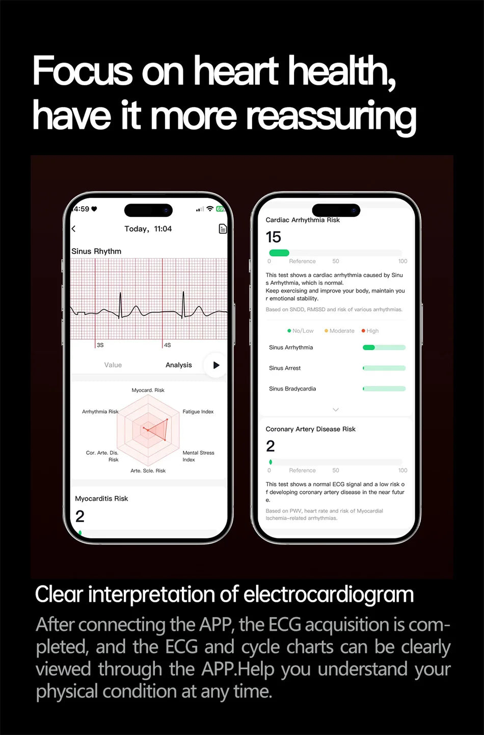ECG+PPG Blood Lipid Smart Watch