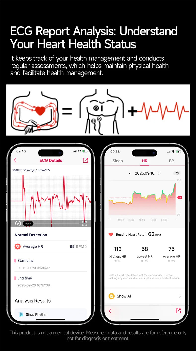 ECG Heart Health Smart Watch